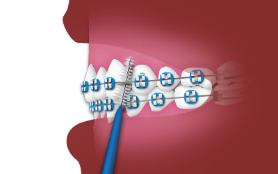 interdental toothbrush